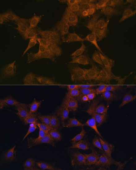 EIF2B2 Rabbit polyclonal antibody