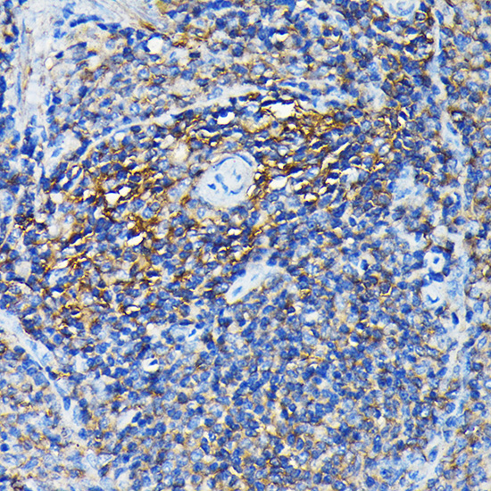 PRC1 Rabbit polyclonal antibody