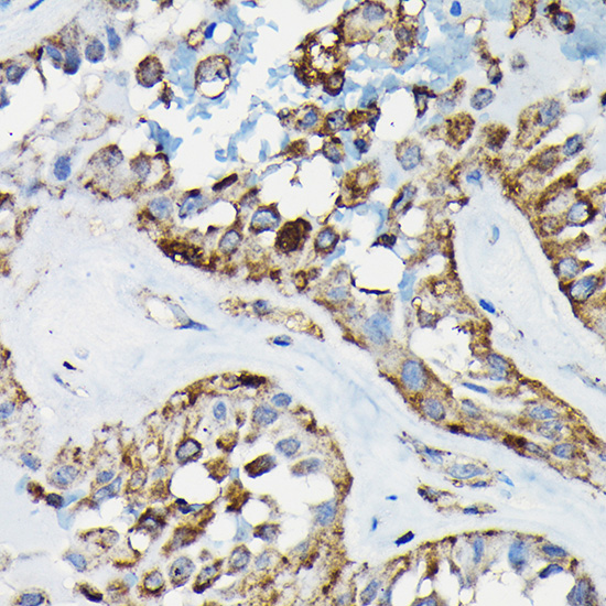 PRC1 Rabbit polyclonal antibody
