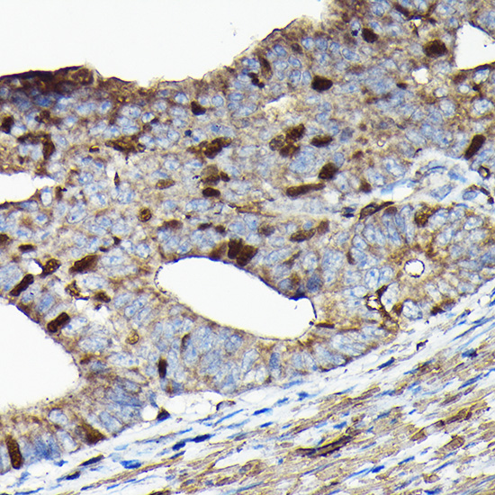 PRC1 Rabbit polyclonal antibody