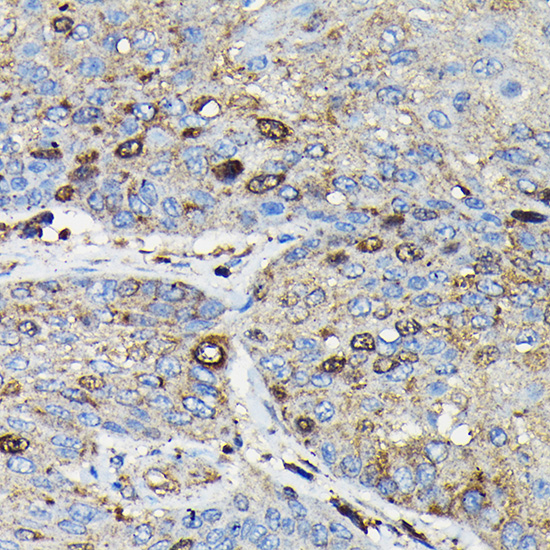 PRC1 Rabbit polyclonal antibody