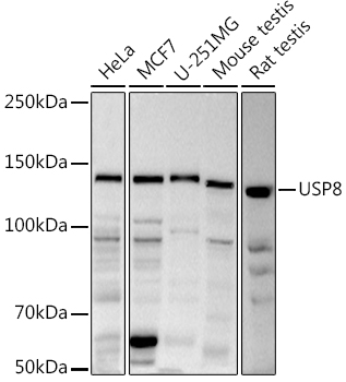 USP8 Rabbit polyclonal antibody