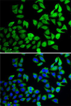 USP8 Rabbit polyclonal antibody