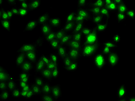 CBFA2T2 Rabbit polyclonal antibody