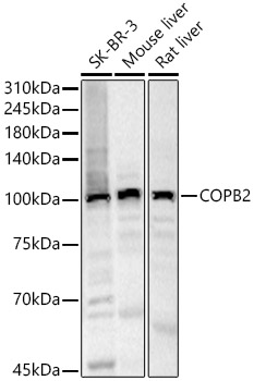 COPB2 Rabbit polyclonal antibody