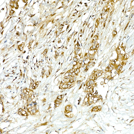 COPB2 Rabbit polyclonal antibody