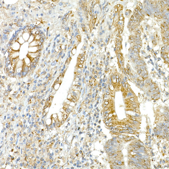COPB2 Rabbit polyclonal antibody