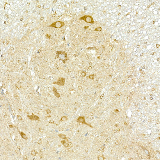COPB2 Rabbit polyclonal antibody