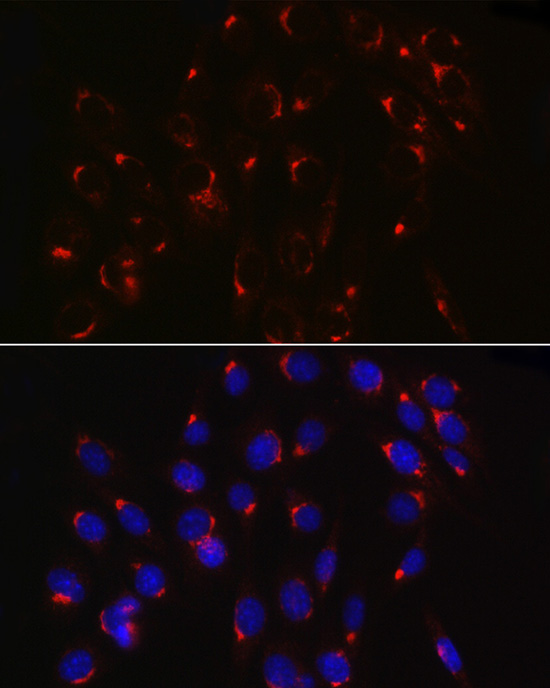 COPB2 Rabbit polyclonal antibody