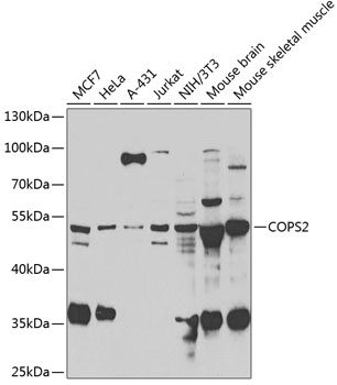 COPS2 Rabbit polyclonal antibody