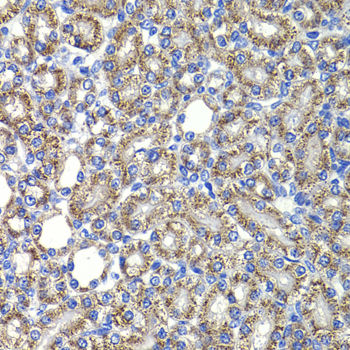 COPS2 Rabbit polyclonal antibody