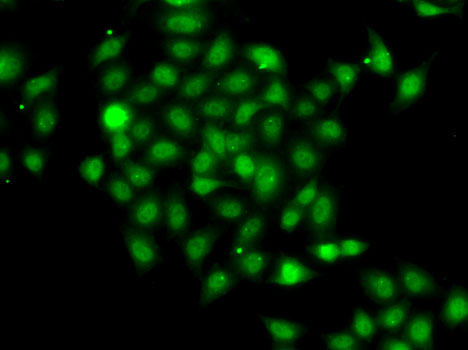 COPS2 Rabbit polyclonal antibody