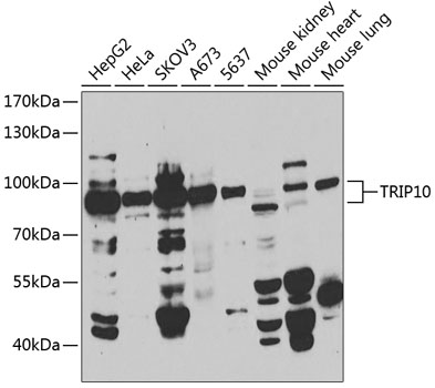TRIP10 Rabbit polyclonal antibody