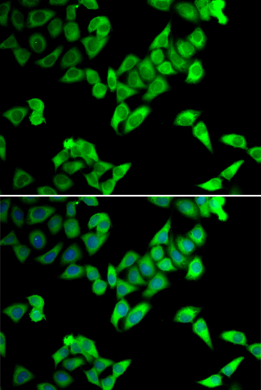 TRIP10 Rabbit polyclonal antibody