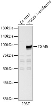TGM5 Rabbit polyclonal antibody