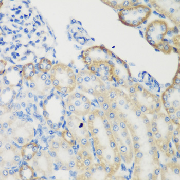 TGM5 Rabbit polyclonal antibody