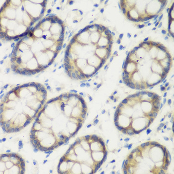 TGM5 Rabbit polyclonal antibody