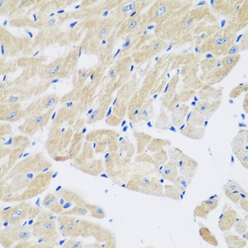 TGM5 Rabbit polyclonal antibody