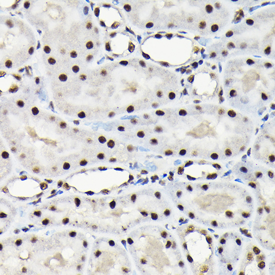 EFTUD2 Rabbit polyclonal antibody