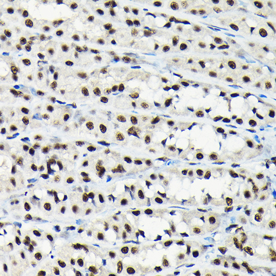 EFTUD2 Rabbit polyclonal antibody