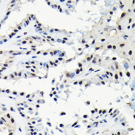 EFTUD2 Rabbit polyclonal antibody