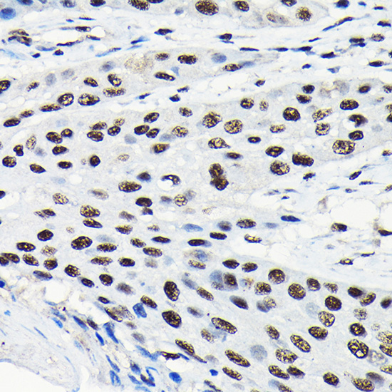 EFTUD2 Rabbit polyclonal antibody