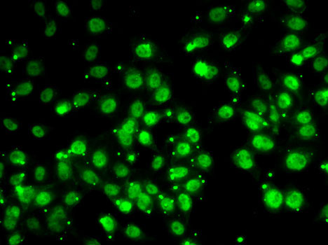 QKI Rabbit polyclonal antibody