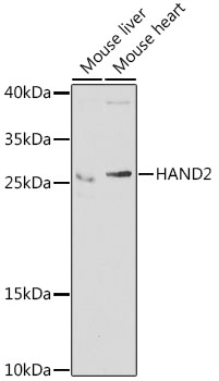 HAND2 Rabbit polyclonal antibody