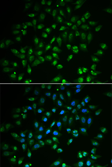 HAND2 Rabbit polyclonal antibody