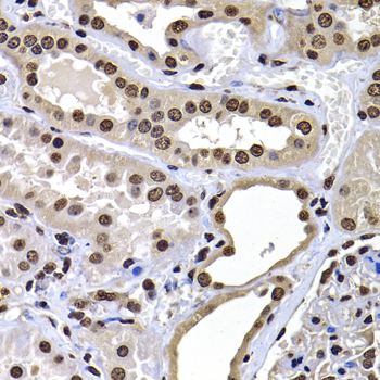[KO Validated] macroH2A.1 Rabbit polyclonal antibody