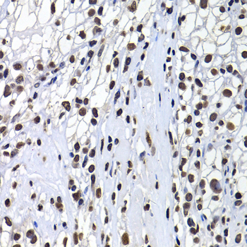 [KO Validated] macroH2A.1 Rabbit polyclonal antibody