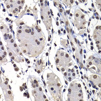 [KO Validated] macroH2A.1 Rabbit polyclonal antibody