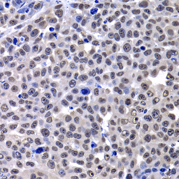 [KO Validated] macroH2A.1 Rabbit polyclonal antibody