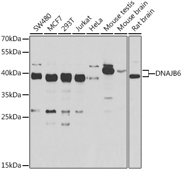 DNAJB6 Rabbit polyclonal antibody