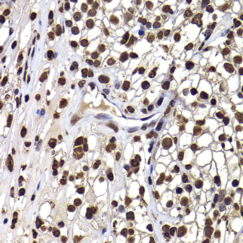 DNAJB6 Rabbit polyclonal antibody