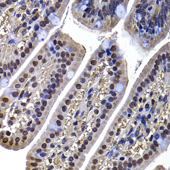 DNAJB6 Rabbit polyclonal antibody