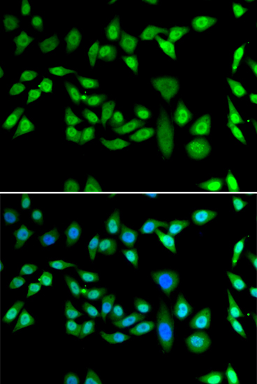 DNAJB6 Rabbit polyclonal antibody