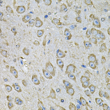 PDIA6 Rabbit polyclonal antibody