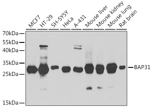 BAP31 Rabbit polyclonal antibody
