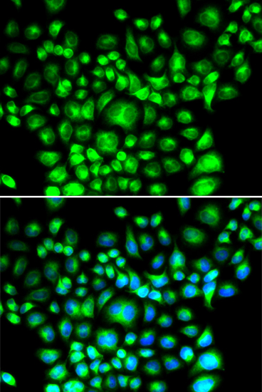 BAP31 Rabbit polyclonal antibody
