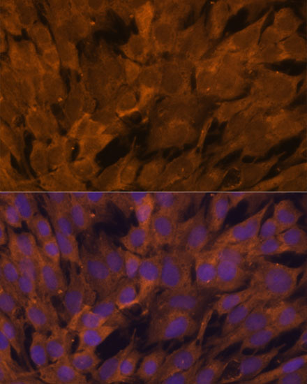 STAM2 Rabbit polyclonal antibody