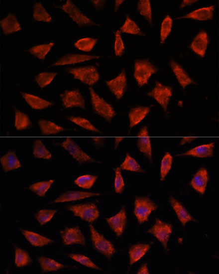 STAM2 Rabbit polyclonal antibody