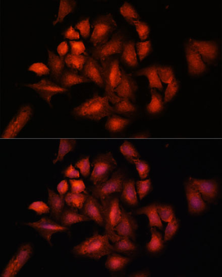 STAM2 Rabbit polyclonal antibody