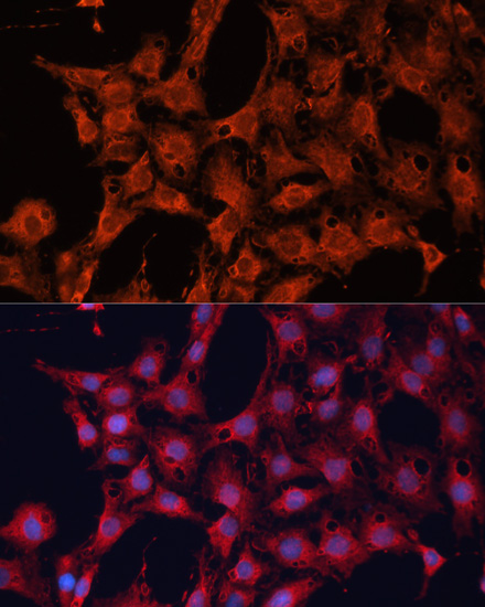 DNAJA2 Rabbit polyclonal antibody