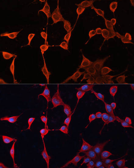 DNAJA2 Rabbit polyclonal antibody