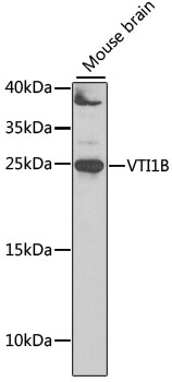 VTI1B Rabbit polyclonal antibody