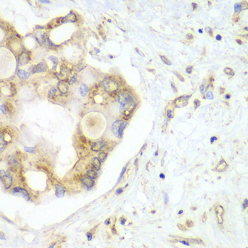 VTI1B Rabbit polyclonal antibody