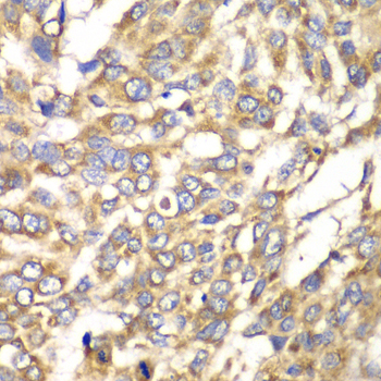VTI1B Rabbit polyclonal antibody