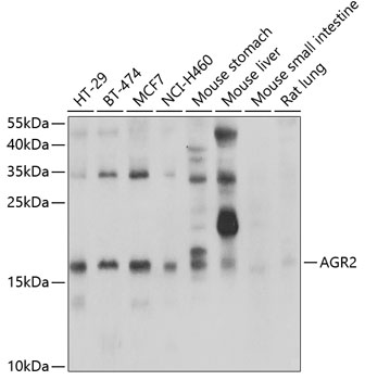 AGR2 Rabbit polyclonal antibody
