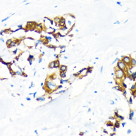 AGR2 Rabbit polyclonal antibody